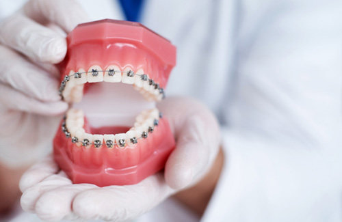 Dentist showing off model of teeth with metal braces 