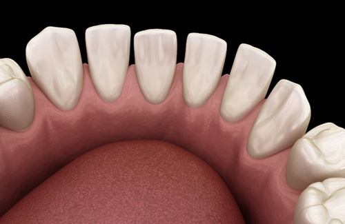 An illustration of gapped teeth