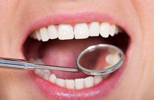 Teeth examined with dental mirror
