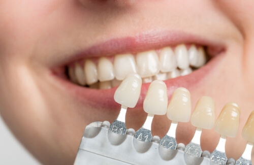 Dentist holding a shade guide next to a smiling patient