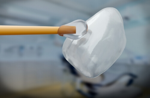 Close up of a dental veneer with bonding liquid on it