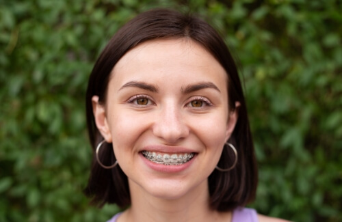 Young woman with traditional braces smiling outdoors