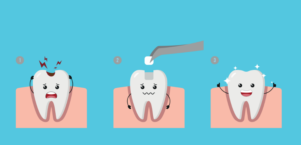 Cartoon of a cavity getting a filling