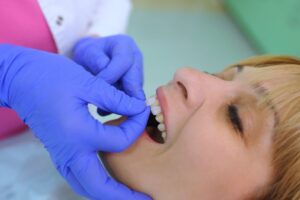 Dentist applying veneers to patient's front teeth. 